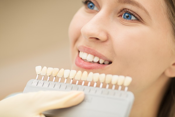 The Benefits Of Dental Veneers
