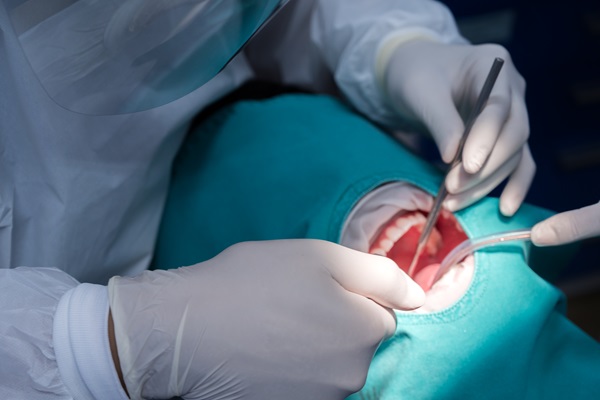 Oral Surgery From A General Dentist For Dental Implant Placement